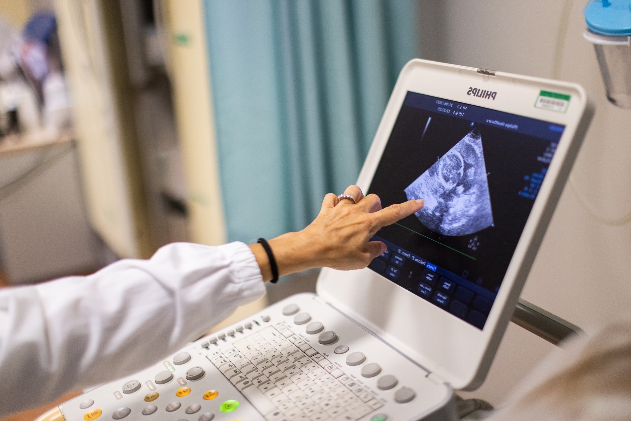 Diagnosi prenatale cardiopatia congenita
